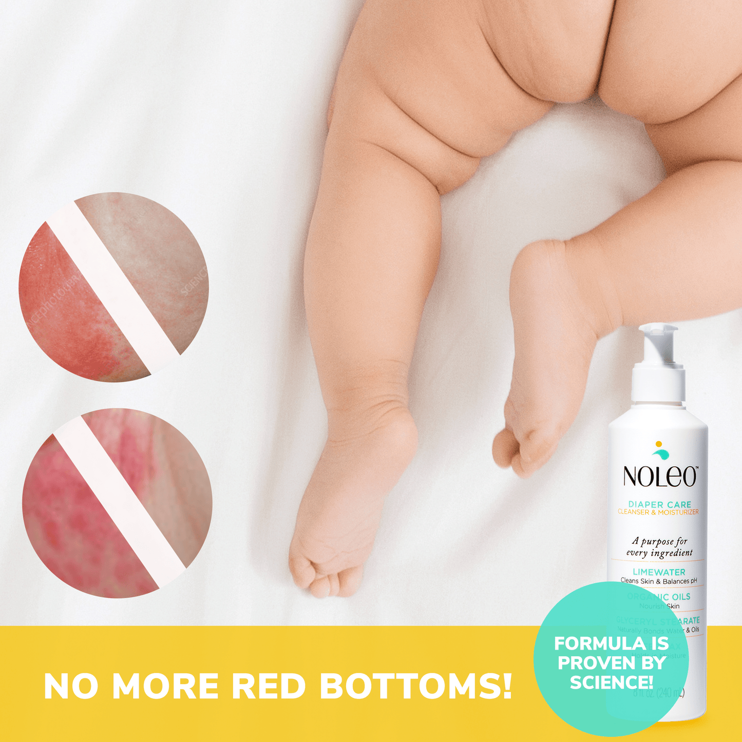 NOLEO DUO: 3-in-1 Diaper Rash Cream & Large Cotton Pads