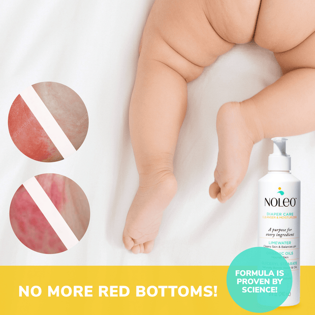 NOLEO DUO: 3-in-1 Diaper Rash Cream & Large Cotton Pads